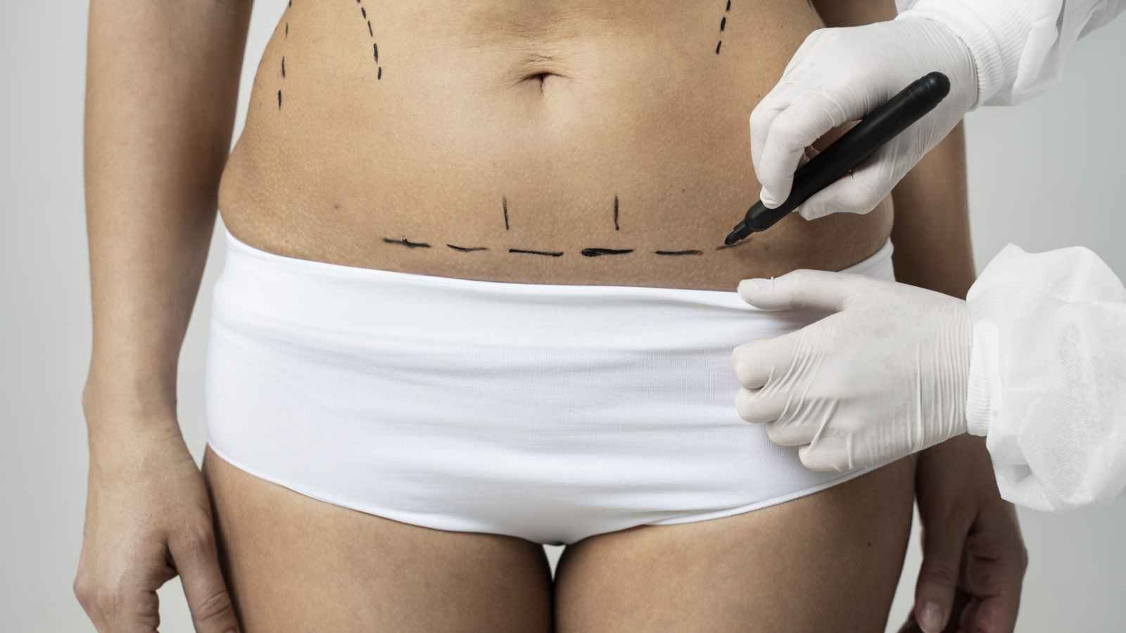 front-view-woman-with-marker-traces-skin